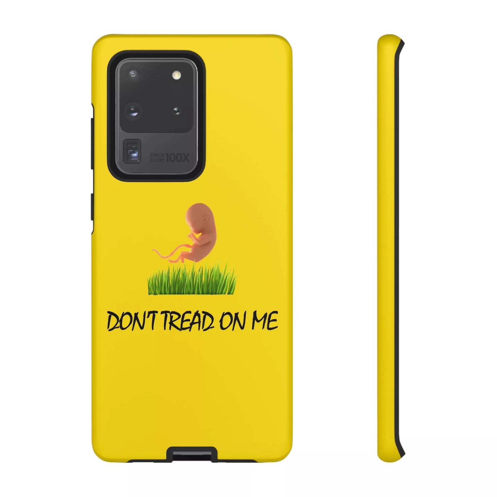 Don't Tread on Baby Phone Case